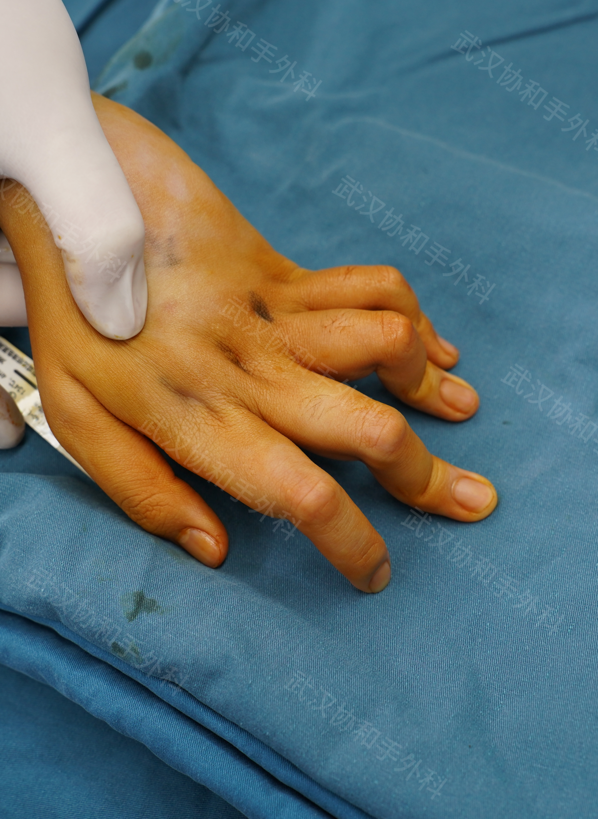 爱游戏链接-包含亚眠球员遭遇伤病困扰未来发展蒙阴影的词条